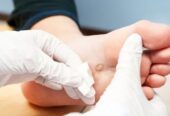 Specialist Foot Clinic for Chiropodist in Lisburn and Moira