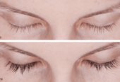 Enhance your eyes with Latisse!
