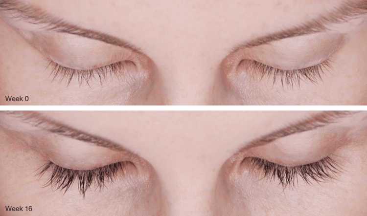 Enhance your eyes with Latisse!