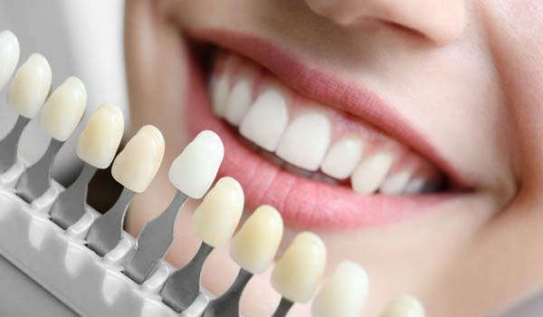 Root canal treatment