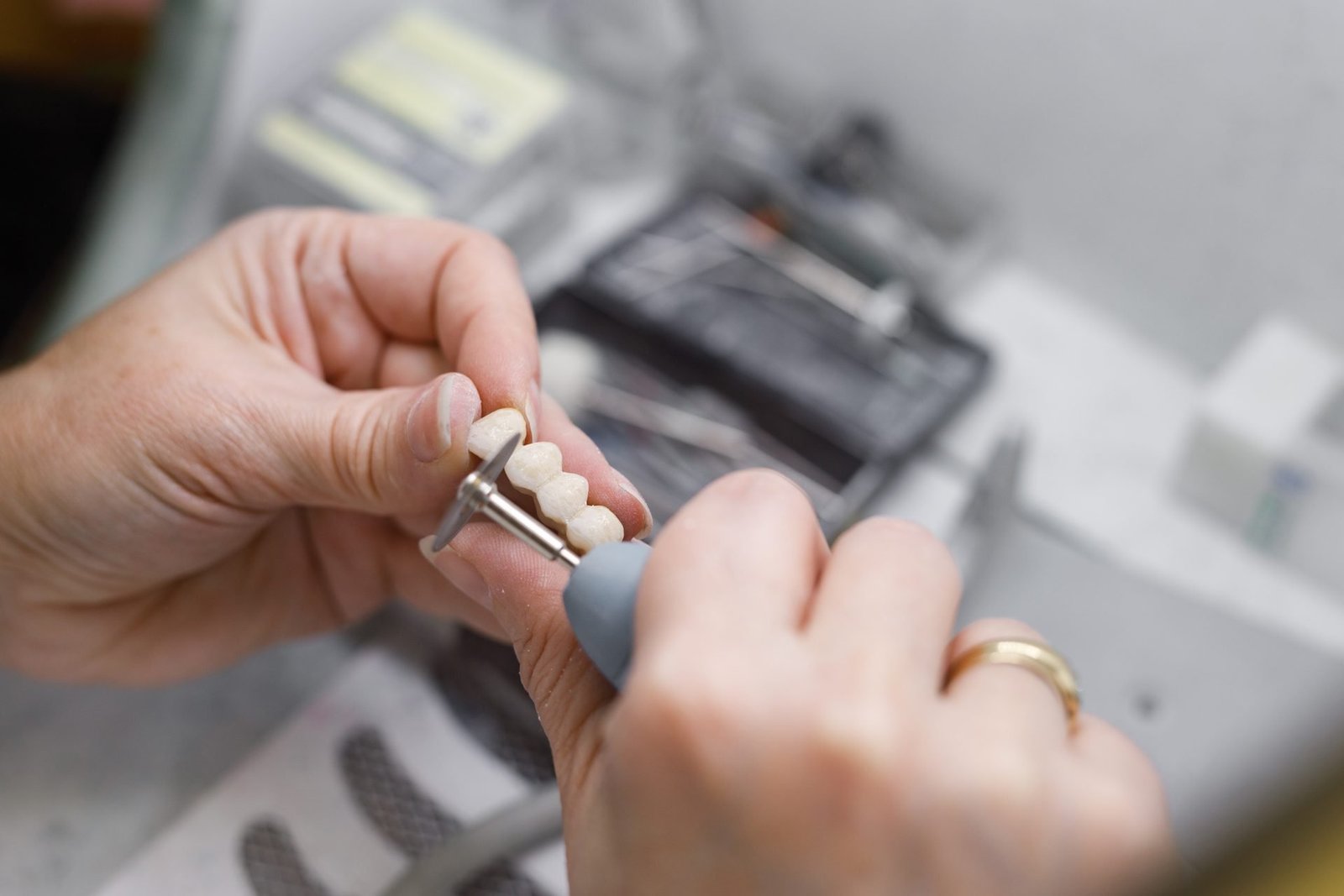 The Best Dental Laboratory in Sussex