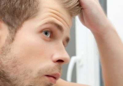 Hair Loss Solutions For Men in The UK