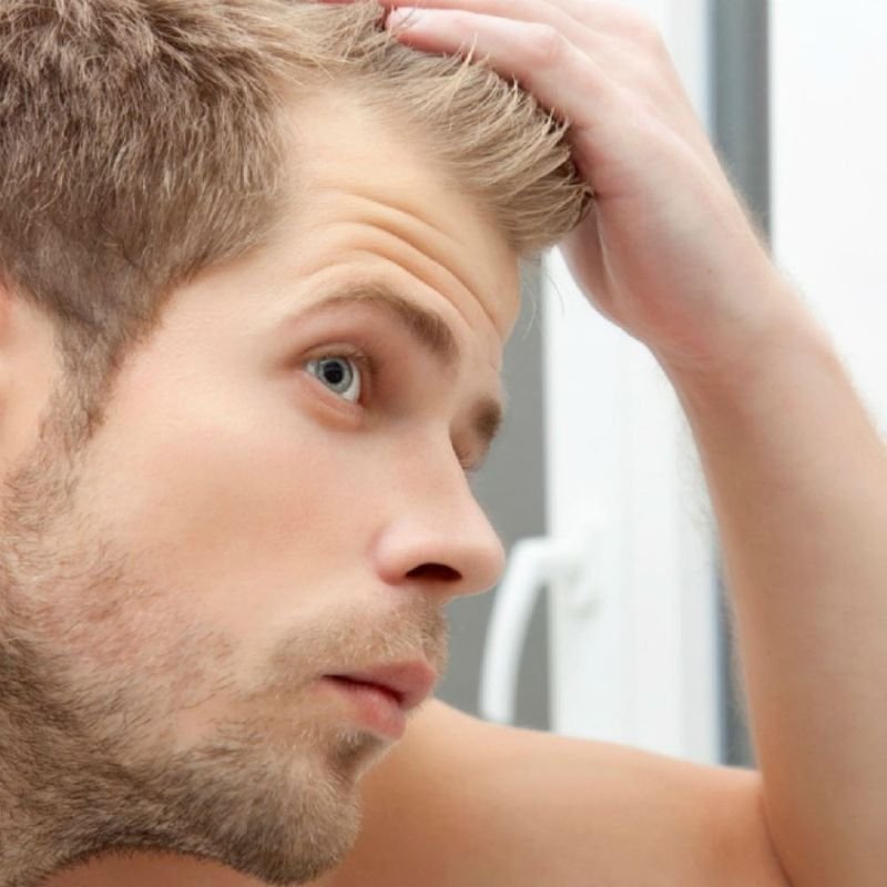 Hair Loss Solutions For Men in The UK