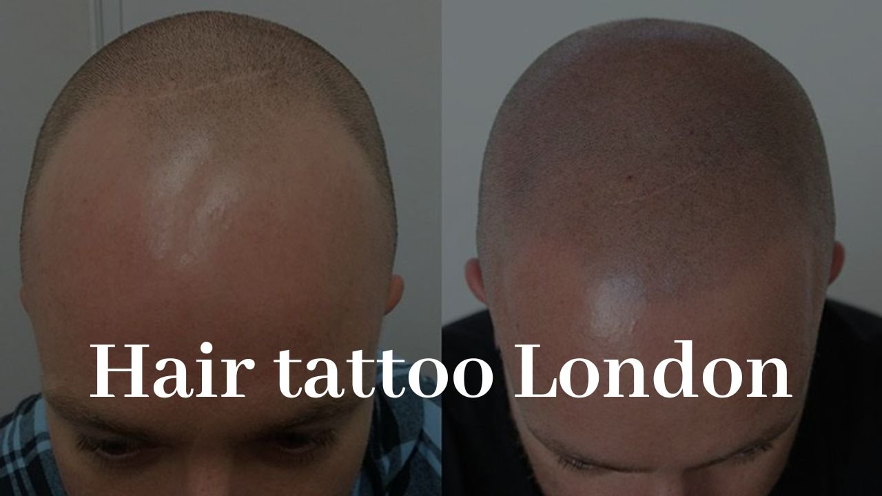 Looking for a hair tattoo for men in the UK?